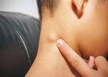 Penyebab Kelenjar Getah Bening Membengkak: Faktor yang Harus Diketahui