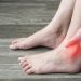 8 Cara Ampuh Mengatasi Asam Urat Secara Alami dan Medis